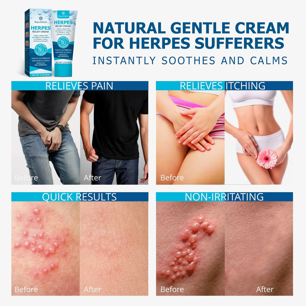 Herpes Cream L161