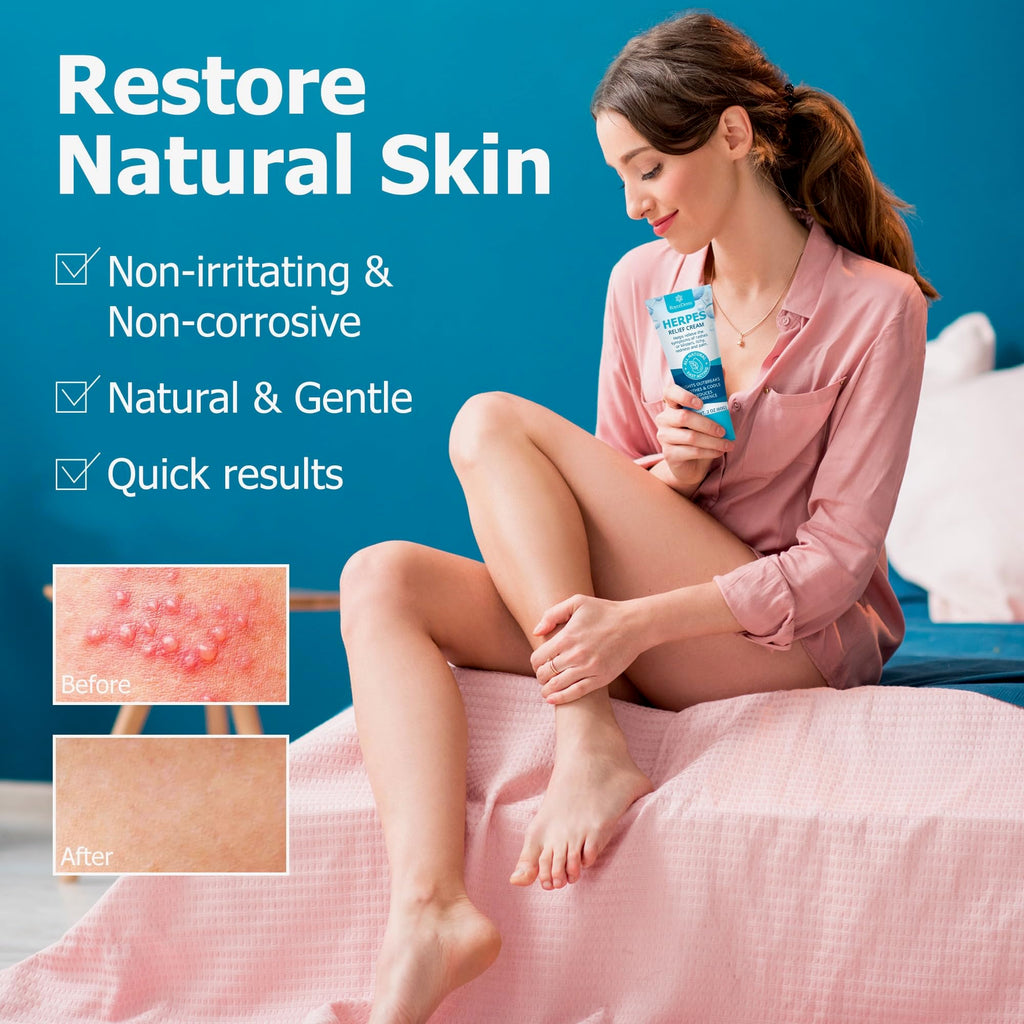 Herpes Cream L161